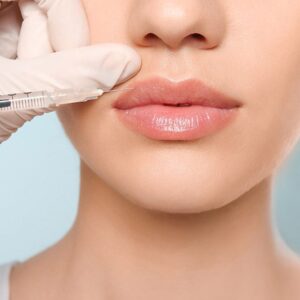 Dermal Fillers